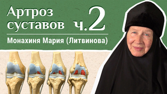 Артроз суставов (часть 2). «Давайте жить здорово!»