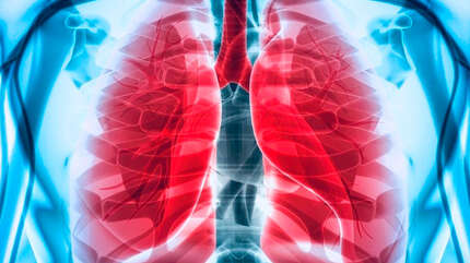 Нелегкое дело — воспаление легких