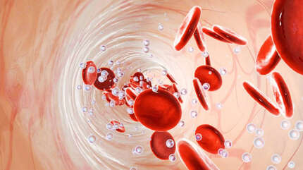 Анемия — железный аргумент