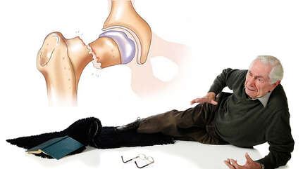 Боремся с остеопорозом