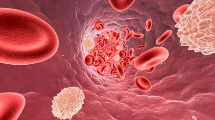 Низкий уровень холестерина — что делать?