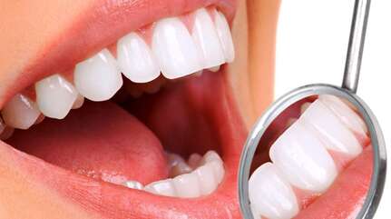 Пародонтоз — как сохранить улыбку?