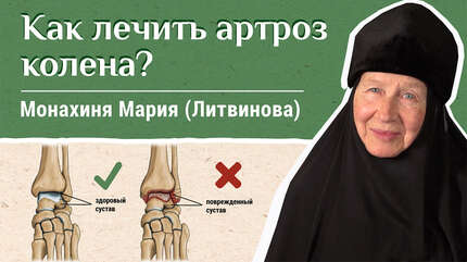 Артроз коленного сустава. «Давайте жить здорово!»