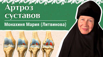 Артроз суставов. «Давайте жить здорово!»